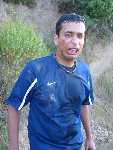 Aftermath of Raj's faceplant